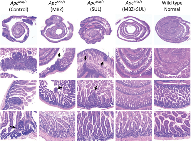 The combination of MBZ plus sulindac reduces the formation of microadenomas.