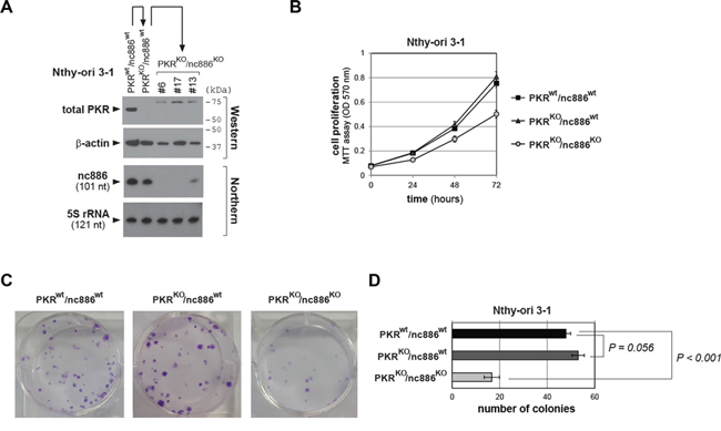 Cell proliferation assays of PKR or nc886 KO cells.