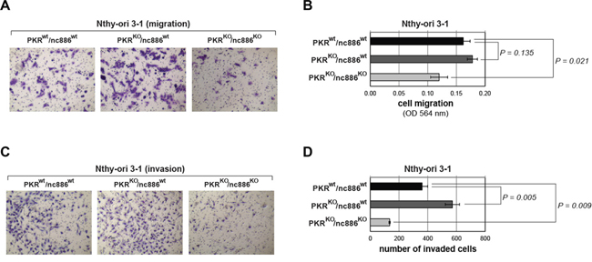 Cell migration and invasion assays for PKR or nc886 KO cells.