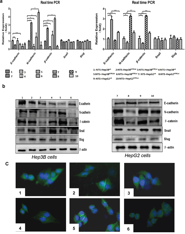 NTS/NTR1 co-expression significantly promoted EMT process in HCC cell lines.