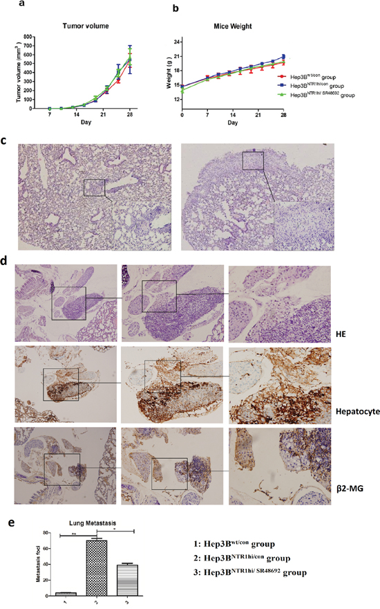 Blocking NTS signaling inhibited HCC metastasis rather than tumor growth in vivo.