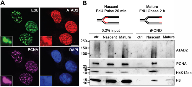 ATAD2 is recruited to DNA replication sites.