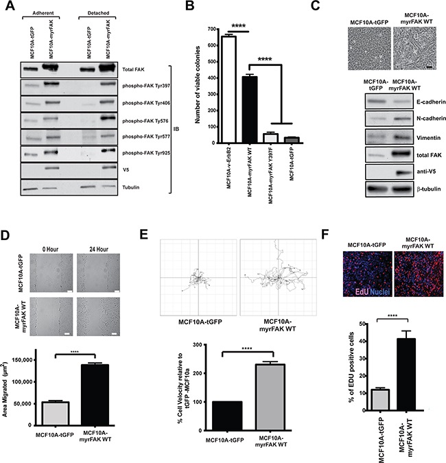 Constitutive activation of FAK in non-transformed MCF10A cells promotes colony formation in soft agar, EMT, migration and proliferation in 2D.