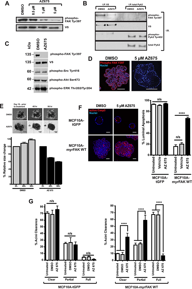 Inhibition of FAK in 3D-mammary cultures selectively induces apoptosis in the luminal cells.