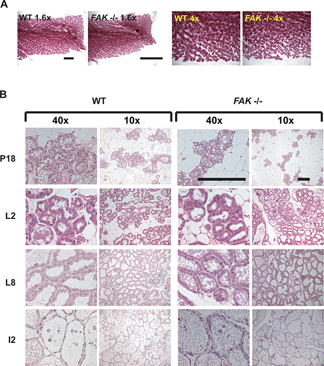 FAK is not required for normal mammary gland function in vivo.