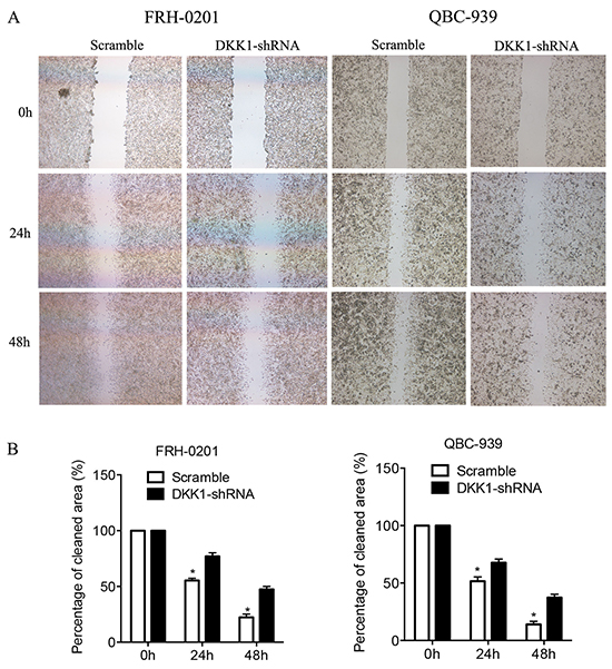 Transfection of DKK1-shRNA represses the migration of QBC939 and FRH0201 cells in vitro.