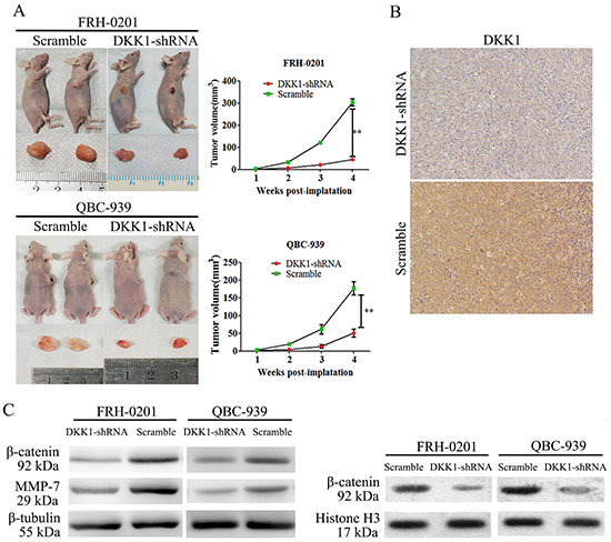 Transfection of DKK1-shRNA impaired QBC939 and FRH0201 cell tumor formation in vivo.