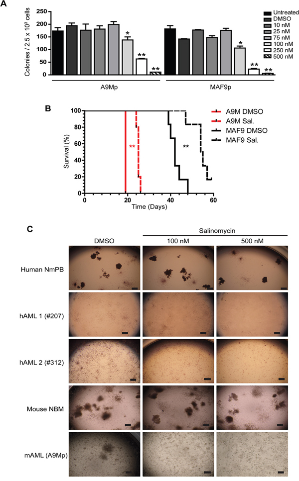 Anti-leukemic effects of salinomycin in primary cells.