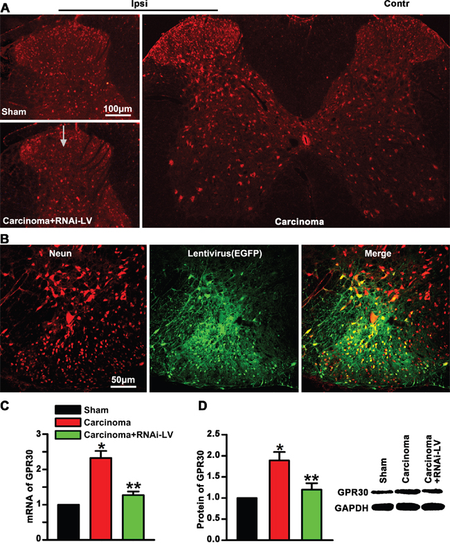 Upregulation of GPR30 in the spinal cord of cancer-bearing rats.