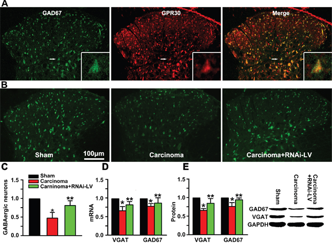 GPR30 diminished inhibitory transmission of GABAergic neurons.