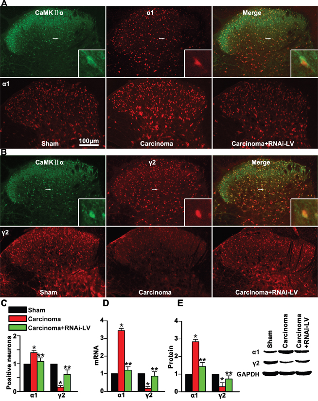 GPR30 diminished GABAergic inhibitory on excitatory neuron.