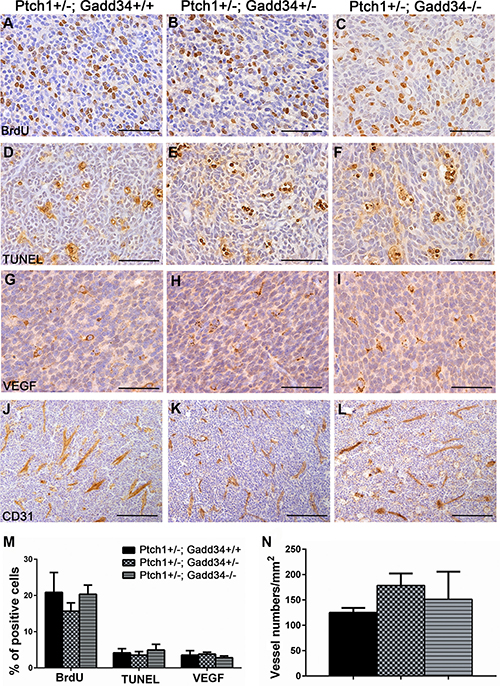 GADD34 mutation did not affect cell proliferation, cell apoptosis or angiogenesis in medulloblastoma in adult Ptch1+/&#x2212; mice.