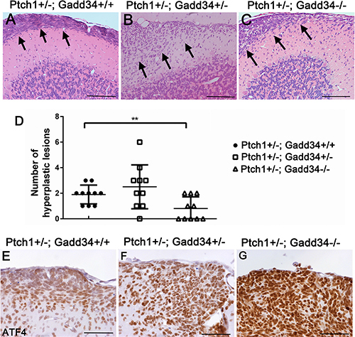 GADD34 mutation altered the number of cerebellar hyperplastic lesions in young Ptch1+/&#x2212; mice.