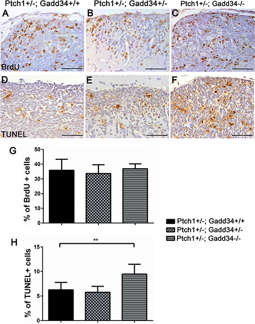 GADD34 homozygous mutation enhanced apoptosis of pre-malignant GCPs in hyperplastic lesions in the cerebellum of young Ptch1+/&#x2212; mice.