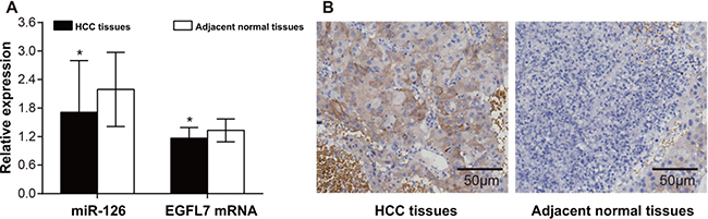 The expressions of miR-126, EGFL7 mRNA and protein in