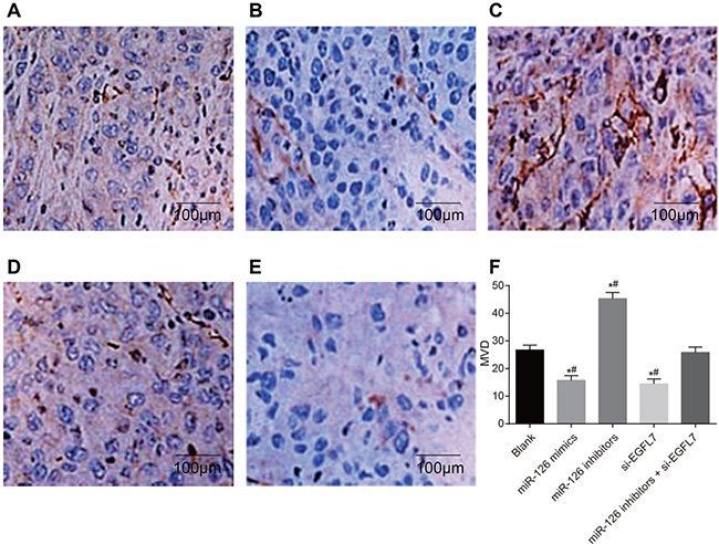 The number of CD31-positive micro-vessels of transplanted tumors in nude mice among different groups detected by immunohistochemistry (&#x00D7; 200).