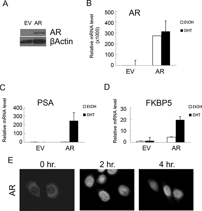 Ectopic expression of AR conferred functional AR-mediated androgen signaling in NHPrE1 cells.