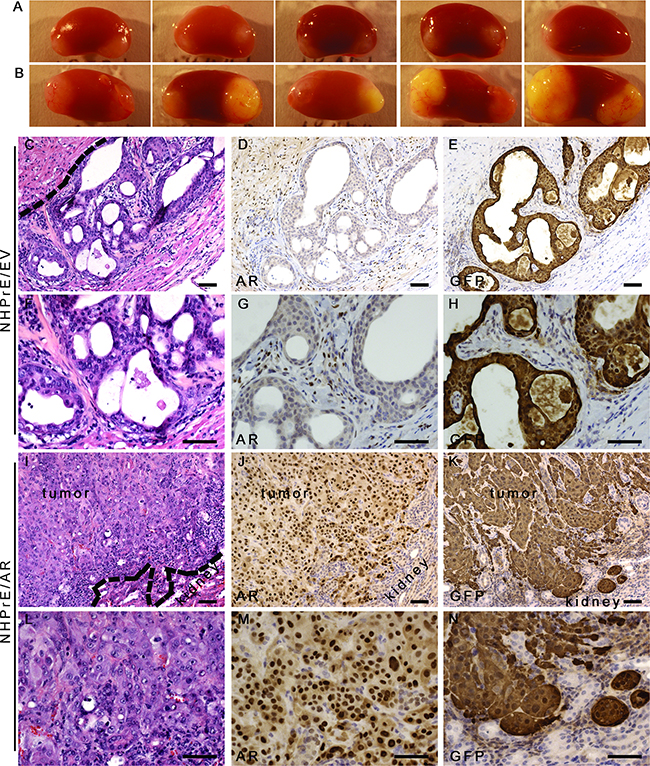 Ectopic-expression of AR transformed NHPrE1 cells in vivo.