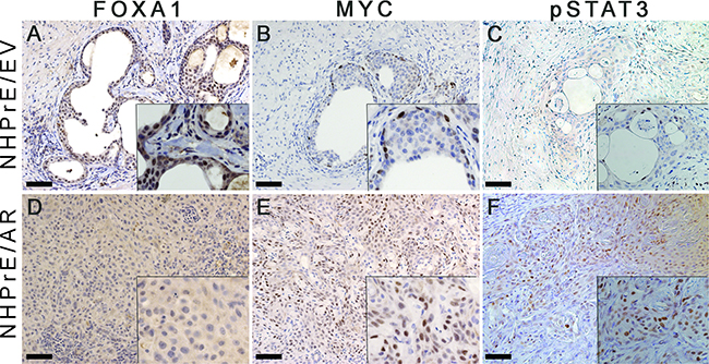 Expression of MYC and pSTAT3, but not FOXA1 was increases in NHPrE1/AR grafts.