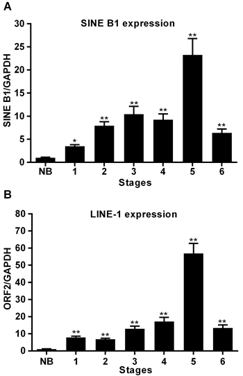 Transcription of SINE B1 and LINE-1 RNA in normal breast tissue (NB) and at the indicated stages of tumor of progression.