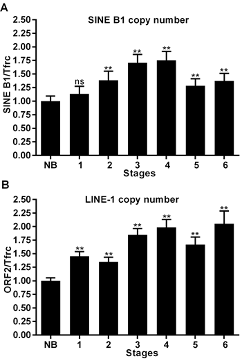 Copy number variations of SINE B1 and LINE-1 retroelements during breast cancer progression.