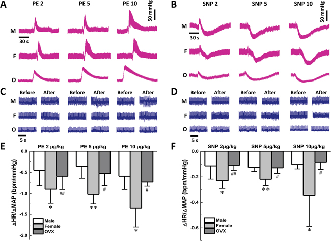 Effect on baroreflex sensitivity of gender difference during vasoactive drugs application.