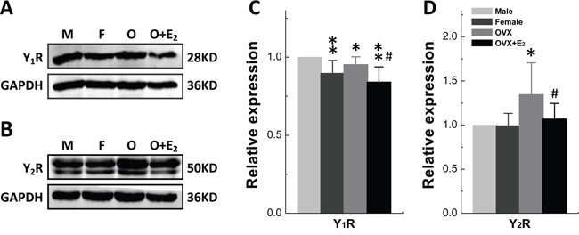 Gender difference in protein expression of Y1R and Y2R in Nodose Ganglia.