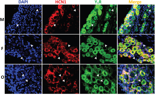 Immunohistochemical staining for Y1R.