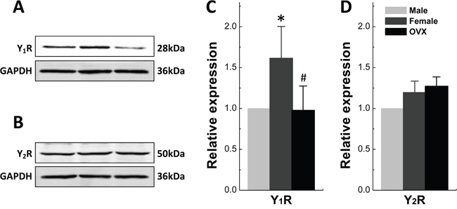 Protein Expression of Y1R and Y2R in Nucleus of Tractus Solitarii.