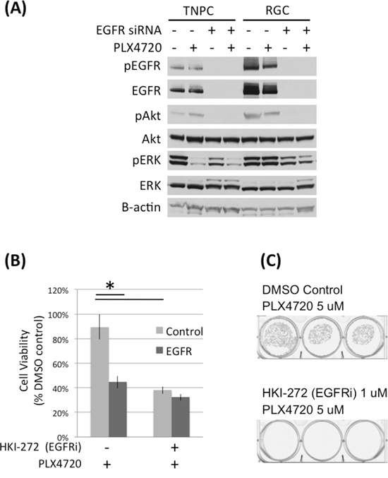 EGFR knock down and inhibition impaired DBTRG-05MG RGC cell viability.