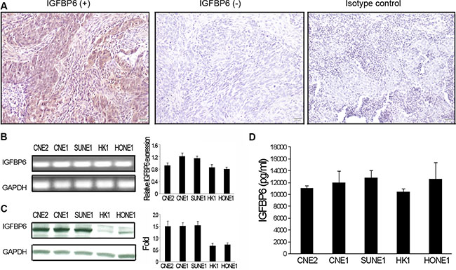 IGFBP6 expression in NPC clinical specimens and cell lines.