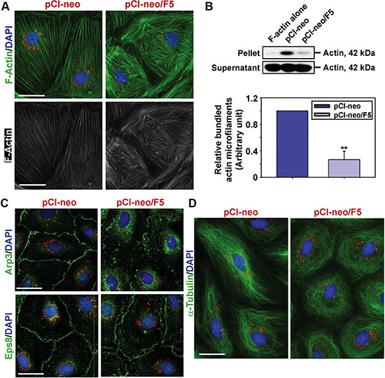 Overexpression of F5-peptide induces re-organization of actin- and microtubule (MT)-based cytoskeletons in Sertoli cells.