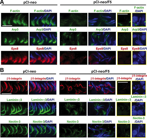 Overexpression of F5-peptide perturbs F-actin organization through changes in the spatial expression of actin regulatory proteins, which in turn disrupts apical ES protein distribution in adult rat testes in vivo.