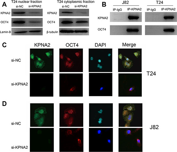 Knockdown of KPNA2 inhibits the nuclear translocation of OCT4 in vitro.