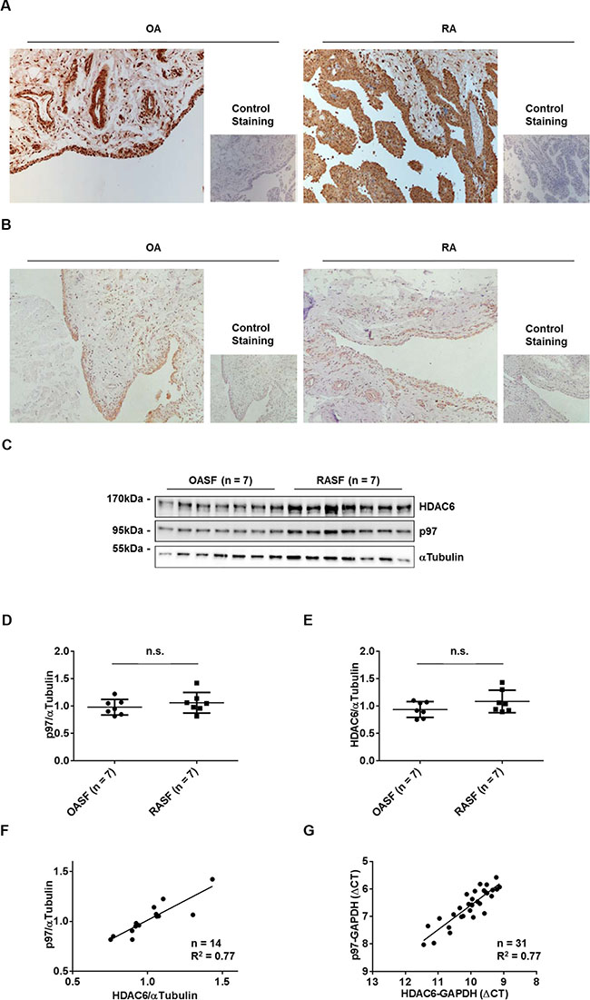 Expression of p97 and HDAC6 in synovial tissues and synovial fibroblasts.