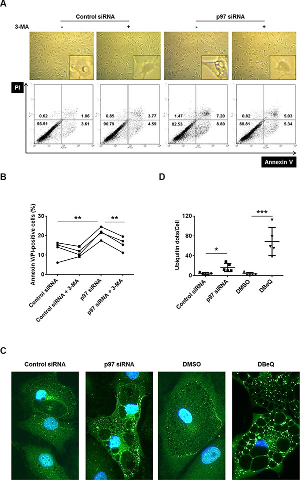 Effects of p97 inhibition on cell death and formation of polyubiquitinated protein aggregates and vacuoles in RASFs under conditions of endoplasmic reticulum stress.