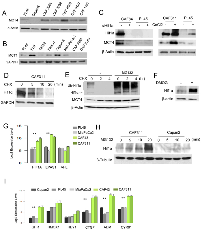 Aberrant HIF1&#x3b1; expression in PDAC cancer associated fibroblasts.