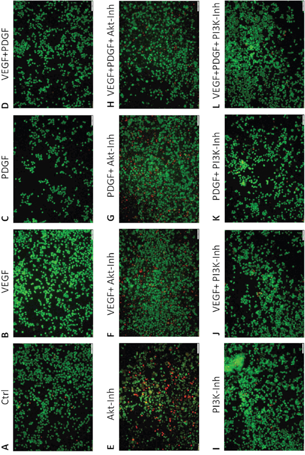 Figure 3. Effect of PDGF stimulation and/or Akt- and PI3K inhibition on apoptosis - Live/Dead Cell staining assay.