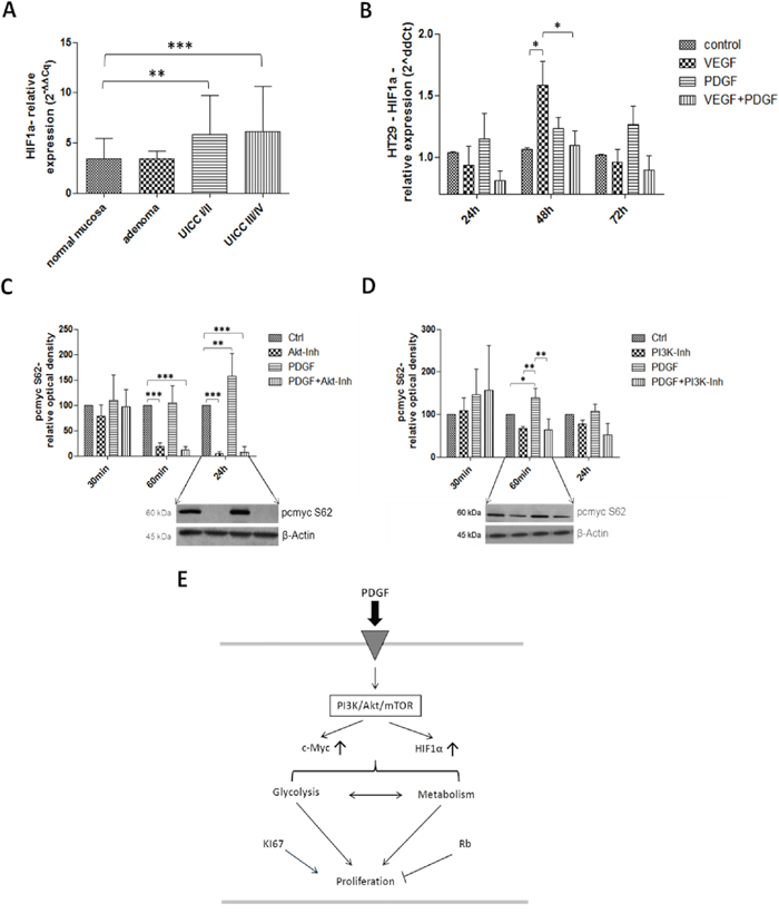 Investigation of HIF1&#x03B1; in human colon cancer probes (A), and in HT29 cells (B) and c-Myc (C and D) in HT29 cells (E).