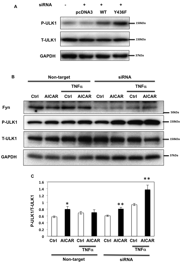 Fyn-mediated AMPK regulation inhibits ULK1 phosphorylation.