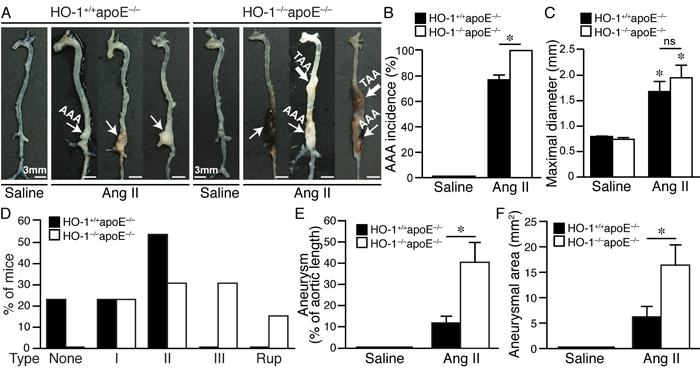 Absence of HO-1 exacerbates angiotensin II-induced aortic aneurysm formation in mice.