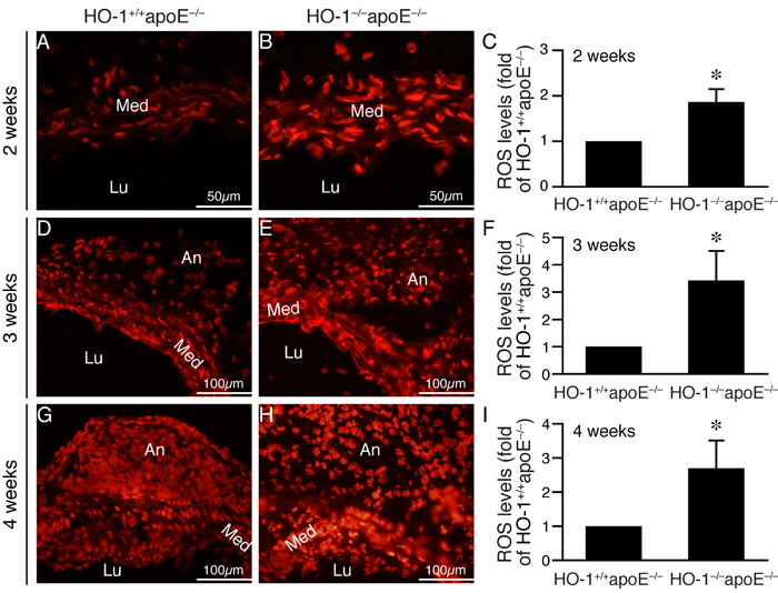 Lack of HO-1 enhances ROS levels in the aortic wall of angiotensin II-infused mice.