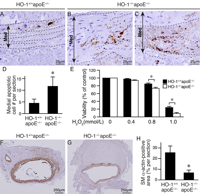 Loss of HO-1 increases VSMC death and reduces VSMC content in AAAs of angiotensin II-infused mice.