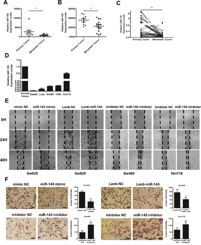 MiR-145 is downregulated in metastatic CRC tumors and inhibits the invasion and metastasis of CRC cells in vitro.