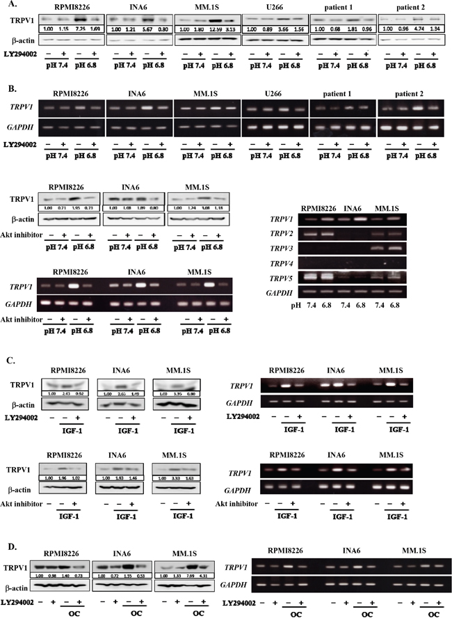 Up-regulation of TRPV1 expression in MM cells under an acidic condition.