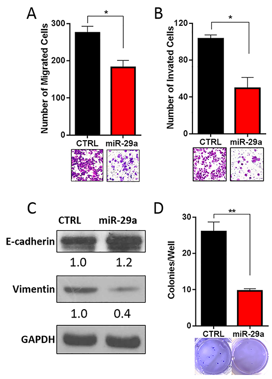 miR-29a inhibits invasive potential of PDAC cells.