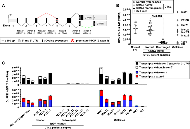 Silencing of DUSP22 alternative transcripts in cutaneous T-cell lymphomas with monoallelic 6p25.3 breakpoints.