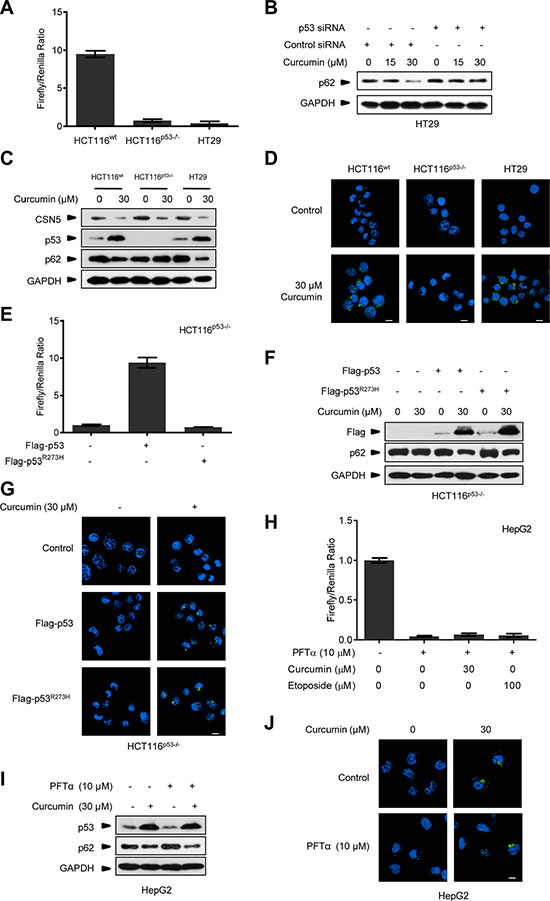 Curcumin controls p53 to induce autophagy uncorrelated to its transcriptional activity.