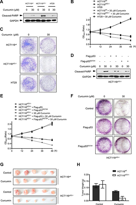 p53-controlled autophagy promotes cancer cell survival under curcumin treatment.