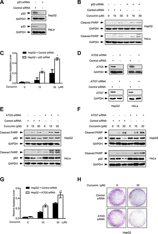 Autophagy inhibition improves the killing effect of curcumin on p53-positive cancer cells.